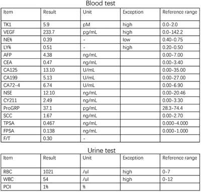 A case report and literature review on TP53 gene mutation in a bladder rhabdomyosarcoma patient